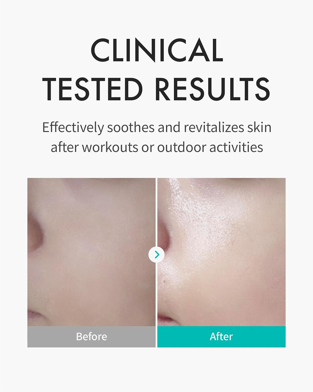 REJURAN - Skin Protection Mask