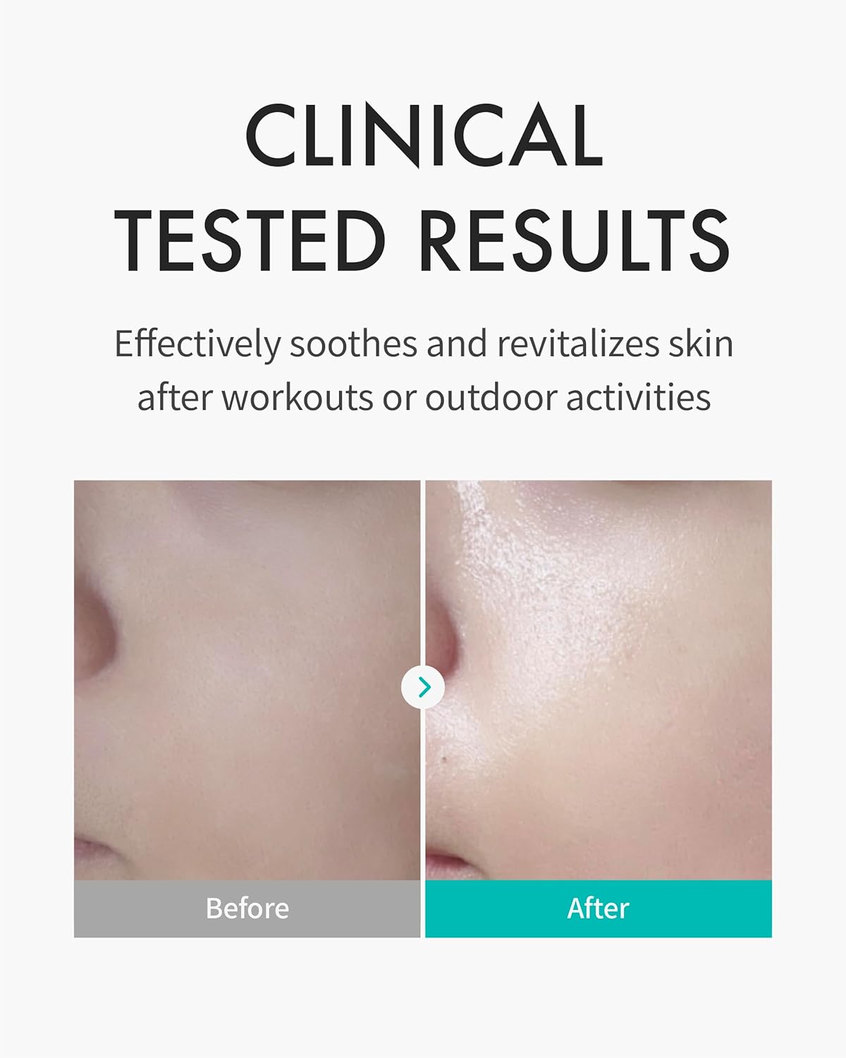 REJURAN - Skin Protection Mask