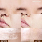 MARSHIQUE - Wrinkle Repair Nasolabial Fold Patch