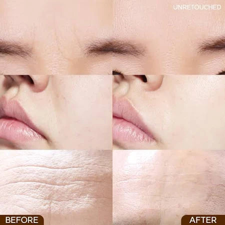 MARSHIQUE - Wrinkle Repair Nasolabial Fold Patch